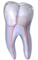 Craze lines - these are tiny cracks that only affect the outer enamel of the tooth.. Fractured Cusp - when a cusp becomes weakened, a fracture may result.