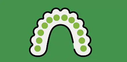 Help with aligner treatment at Smiles Dental